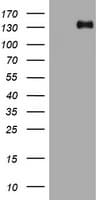 Hamartin / TSC1 Antibody (clone OTI3A2)