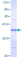 Human NR2E1 / TLX Protein (Recombinant GST, N-terminus)