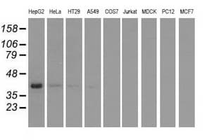 HIBCH Antibody (clone OTI2A5, Carrier-free)