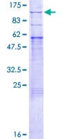 Human PRLR / Prolactin Receptor Protein (Recombinant GST)