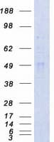 Human CAMK2A / CaMKII Alpha Protein (Recombinant Myc-DDK (Flag))