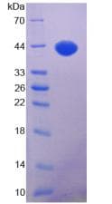 Human IGF1 Protein (Recombinant His-GST)