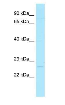 Polyclonal Rabbit anti-Human MBD3L1 Antibody (C-Terminus, WB)