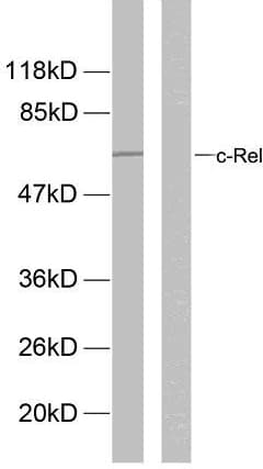 Polyclonal Rabbit anti-Human REL / C-Rel Antibody (phospho-Ser503, IHC, WB)