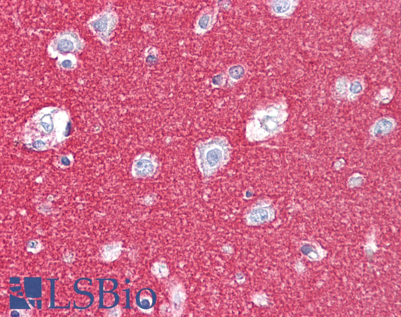 PathPlus™ NCAM / CD56 Antibody (clone 123C3)