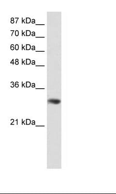 GNB2L1 / RACK1 Antibody (C-Terminus)