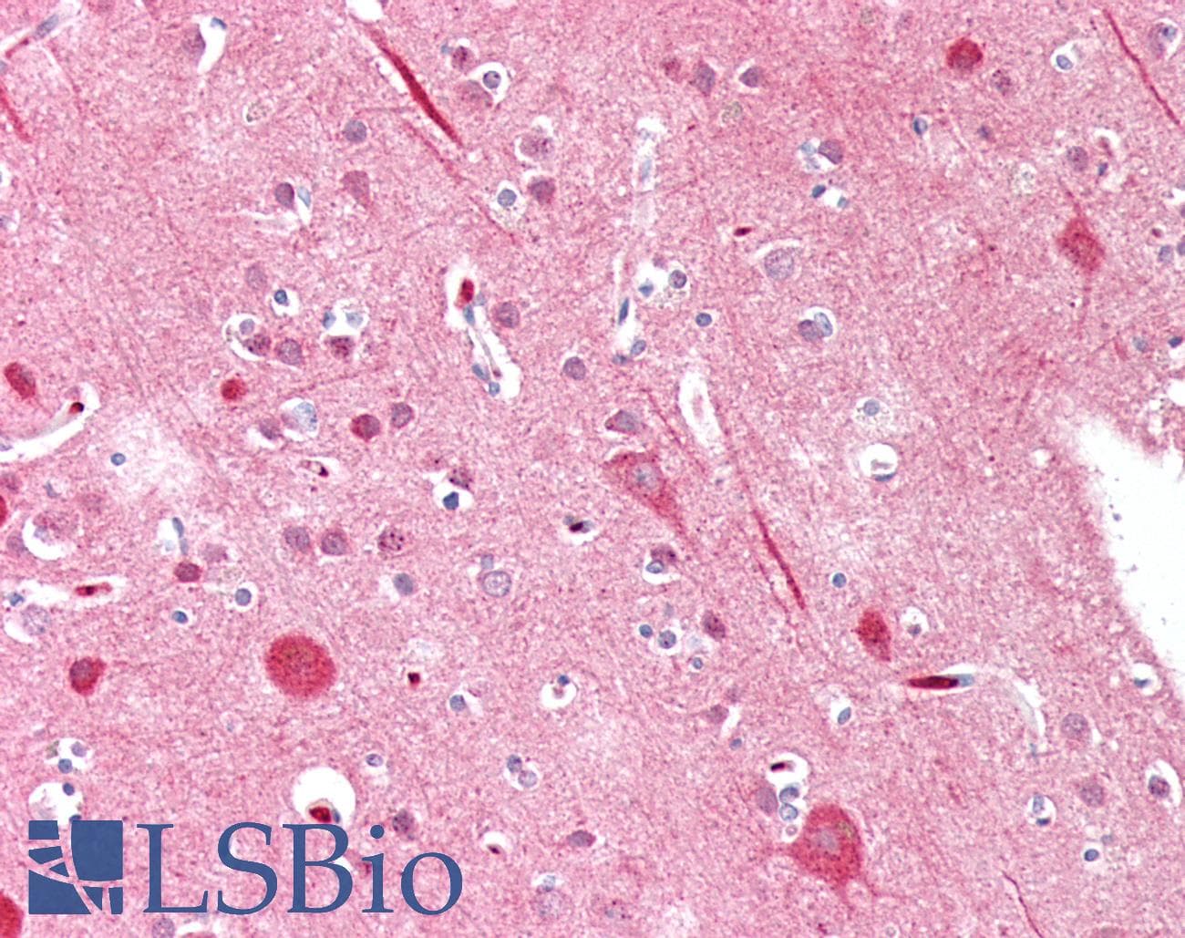 IHC-plus™ MYF5 / MYF 5 Antibody (aa7-36)