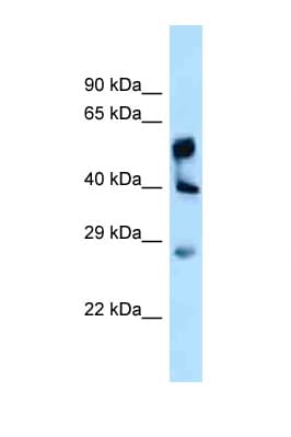 Polyclonal Rabbit anti-Human LPGAT1 Antibody (aa230-279, WB)