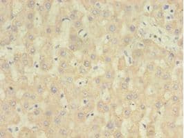 RARRES2 / Chemerin Antibody (aa21-157, Biotin)