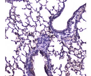 E-FABP / FABP5 Antibody