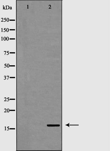 CD247 / CD3 Zeta Antibody