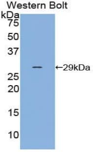 SELP / P-Selectin / CD62P Antibody (aa198-432)