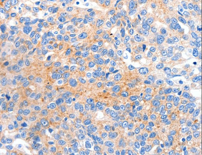 HCN2 Antibody