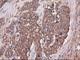 Monoclonal Mouse anti-Human CPA1 / Carboxypeptidase A Antibody (clone OTI2A3, IHC, IF, WB)