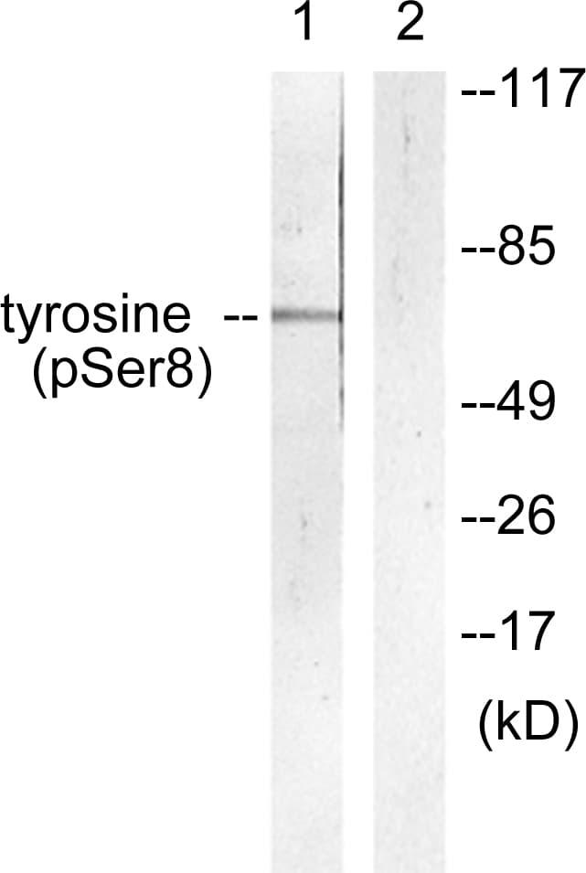 TH / Tyrosine Hydroxylase Antibody (phospho-Ser8)
