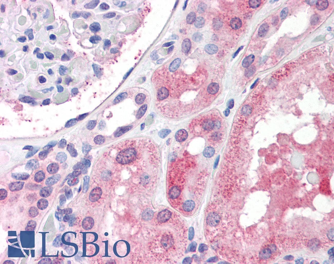 IHC-plus™ CD316 / IGSF8 Antibody (Internal)