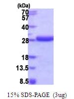Human HDDC2 Protein (Recombinant His)