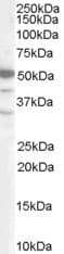 IHC-plus™ SMARCE1 / BAF57 Antibody (aa364-376)