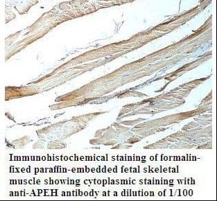 Polyclonal Rabbit anti-Human APH / APEH Antibody (aa2-197, IHC, WB)
