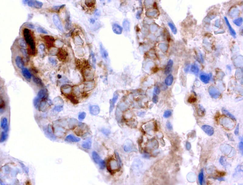Alpha-Fetoprotein Antibody (clone UMAB66)