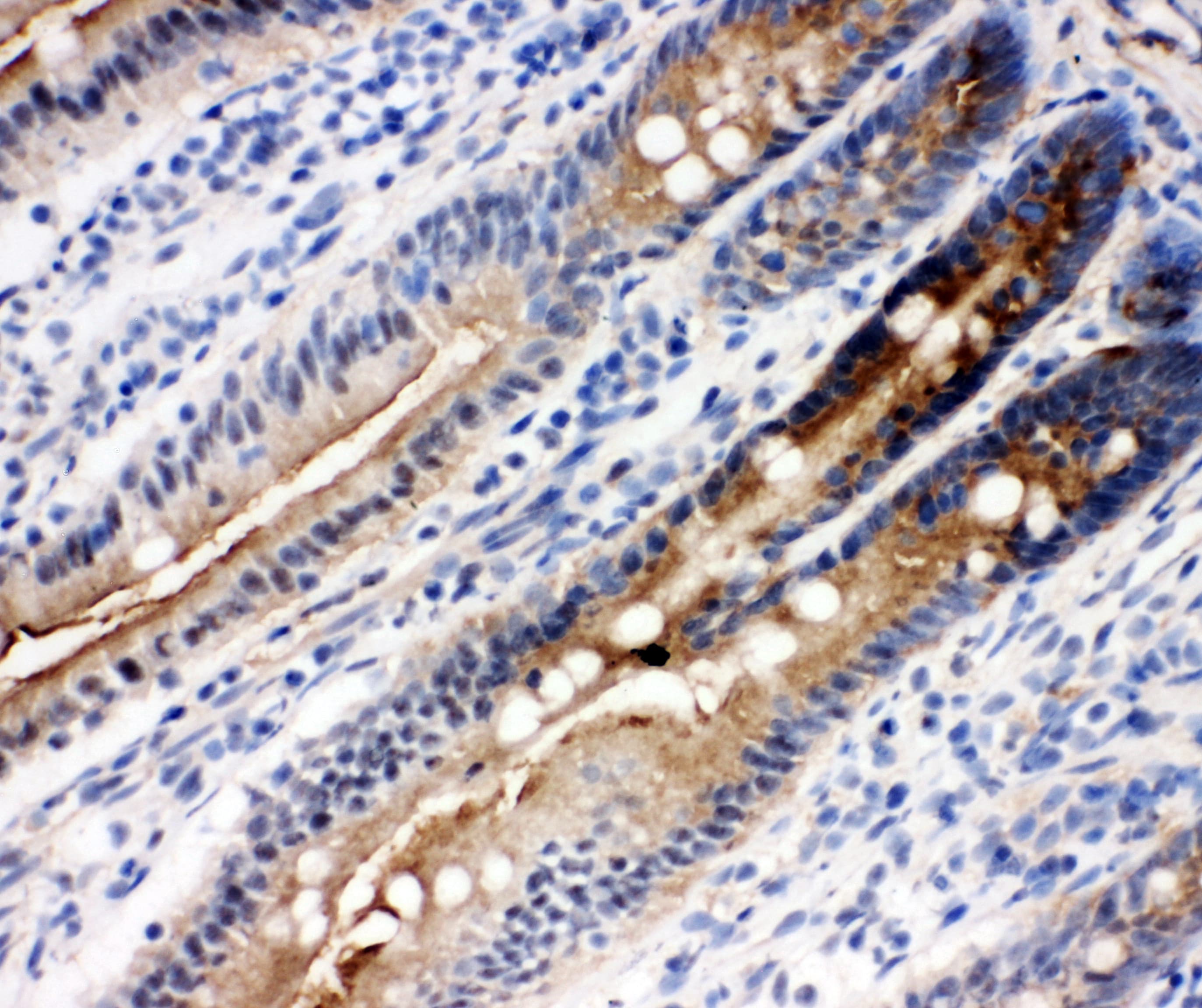 DDX4 / VASA Antibody (aa253-272)
