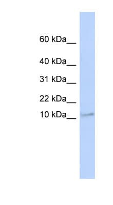 TMEM93 Antibody (N-Terminus)