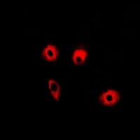 ABAT Antibody