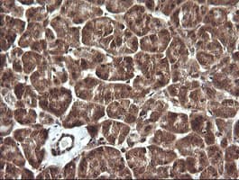 FAK / Focal Adhesion Kinase Antibody (clone OTI4G7)