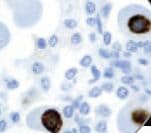Monoclonal Mouse anti-Human CMV / Cytomegalovirus Antibody (clone 8B1.2, 1G5.2 & 2D4.2, Ready-to-Use, IHC)