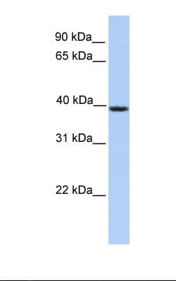 SERPINA5 / PCI Antibody (aa326-375)