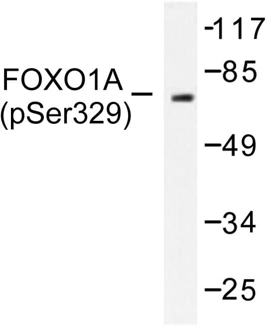 FOXO1 / FKHR Antibody (phospho-Ser329)