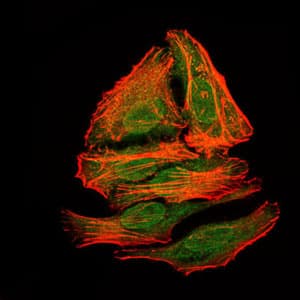 IHC-plus™ BPIFA2 / SPLUNC2 Antibody (clone 1F12)