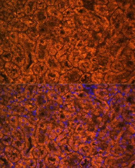 SCNN1A / ENaC Alpha Antibody