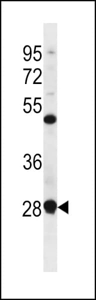 CGI-96 / RRP7A Antibody (aa240-269)