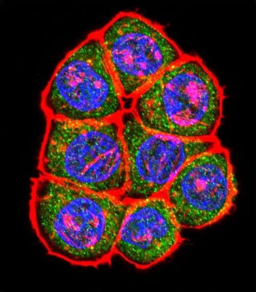 Polyclonal Rabbit anti-Human TBP / GTF2D Antibody (aa301-330, IHC, IF, WB)