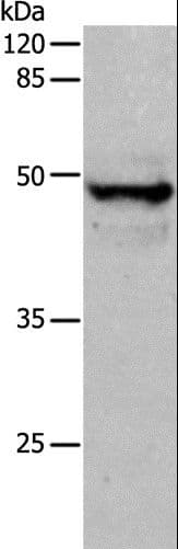 KRT15 / CK15 / Cytokeratin 15 Antibody