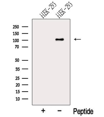 Polyclonal Rabbit anti-Human MTHFD1 Antibody (WB)