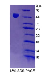 Rat PLAU / Urokinase / uPA Protein (Recombinant His-T7)