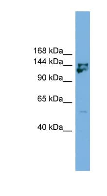 MYBBP1A Antibody (aa1151-1200)