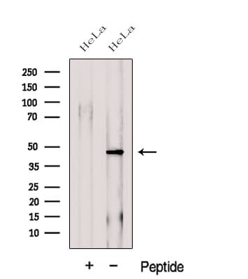 FLCN / Folliculin Antibody
