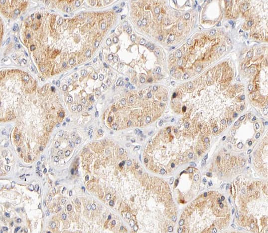 Polyclonal Rabbit anti-Human KRT17 / CK17 / Cytokeratin 17 Antibody (IHC, IF, WB)