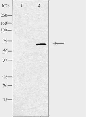 CILD9 / DNAI2 Antibody