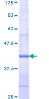 Human IGSF1 Protein (Recombinant GST, N-terminus)