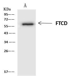 FTCD / 58K Golgi Protein Antibody