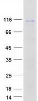 Human Junctophilin 2 / JPH2 Protein (Recombinant Myc-DDK (Flag))