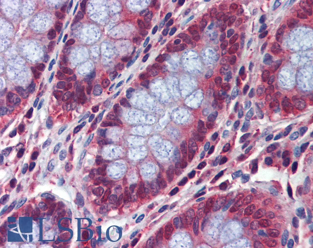 IHC-plus™ DPR2 / DACT2 Antibody