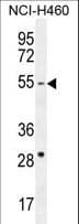 Polyclonal Rabbit anti-Human CD2BP2 Antibody (aa24-52, IHC, WB)
