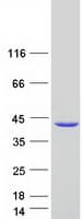 Human STARD7 Protein (Recombinant Myc-DDK (Flag))