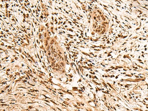 Polyclonal Rabbit anti-Human PPM1G Antibody (IHC)