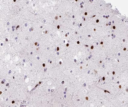 HNRNPD / AUF1 Antibody